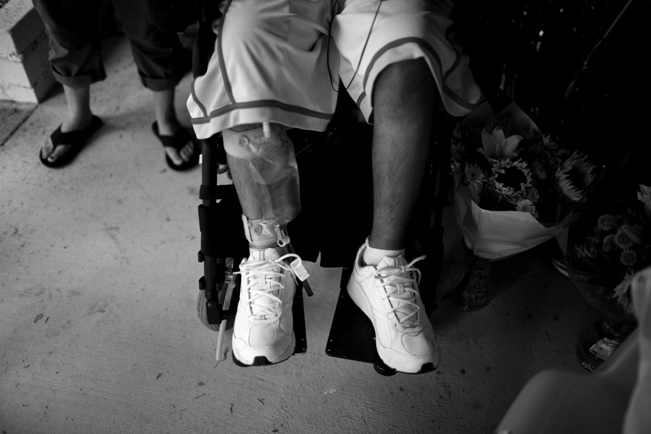 A bag of urine hangs on Isaac Salas' leg after his return home on Thursday, Aug. 4, 2011, in Cheyenne. Isaac remained on a catheter following his release from Craig Hospital. He died Saturday, Sept. 3, 2011, due to complications following a procedure to pulverize urinary tract stones that were blocking his catheter. (James Brosher/Wyoming Tribune Eagle)